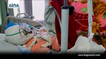ट्रान्सफर्मर विस्फोटमा मजदूर गम्भीर घाइते, उपचार खर्च जुटाउन परिवारलाई समस्या
