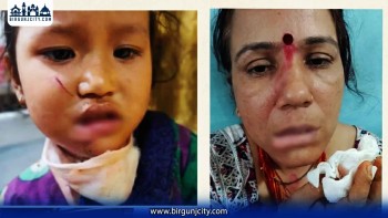 टोकाहा कुकुरको आतंक, महिला र बालबालिकासहित तीन जना घाइते