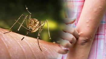 जापानिज इन्सेफलाइटिसबाट बारा सहित देशभर ११ को मृत्यु, ६३ संक्रमित
