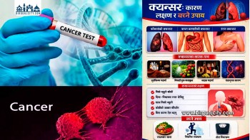 क्यान्सर समयमै उपचार गरेमा निको हुने रोग : विशेषज्ञ