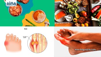 उच्च युरिक एसिड: जोर्नी दुखाइ, सुन्निने र जलनलाई बेवास्ता नगर्नुहोस्